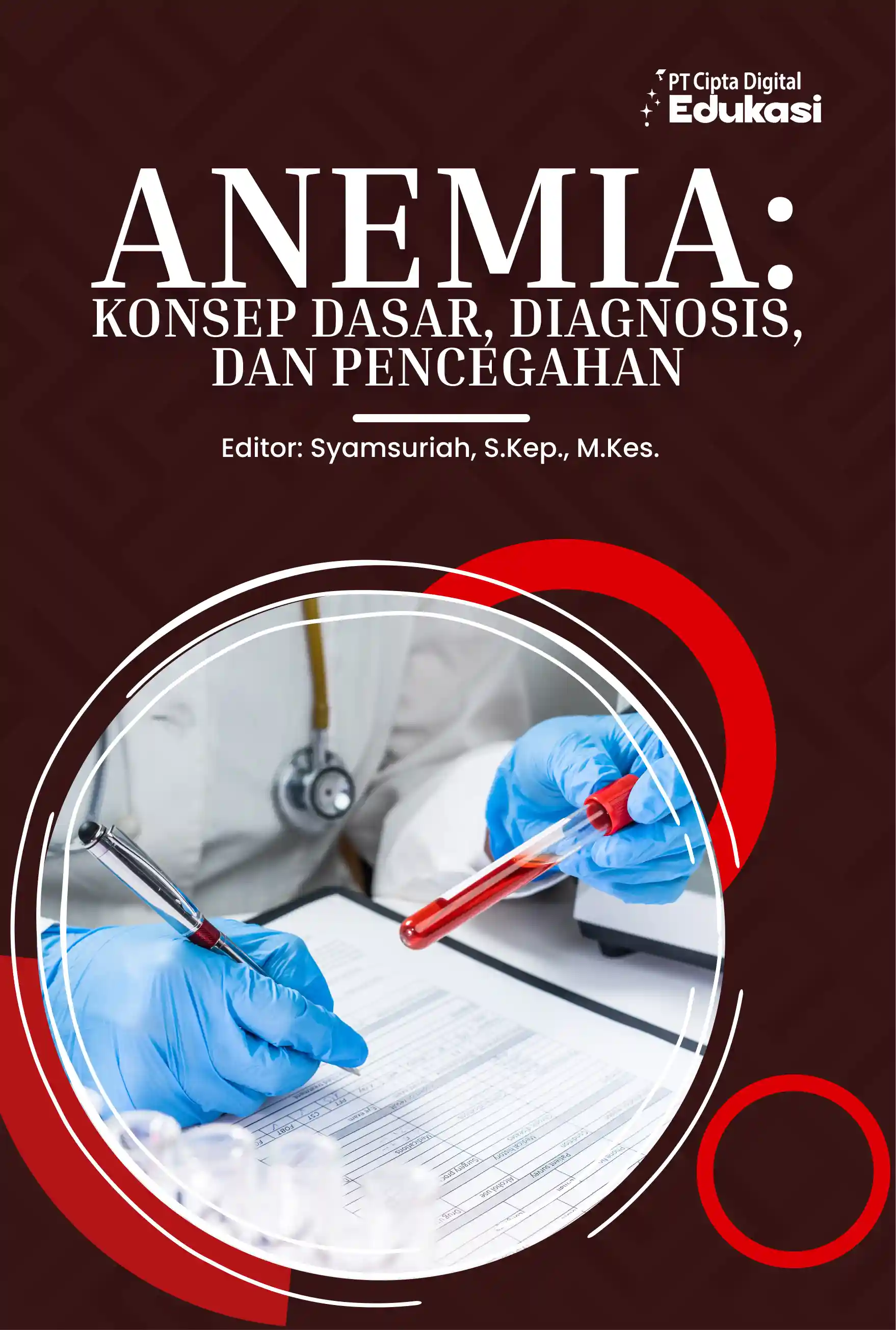Anemia: Konsep Dasar, Diagnosis, dan  Pencegahan